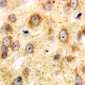 Anti-CD226 Antibody